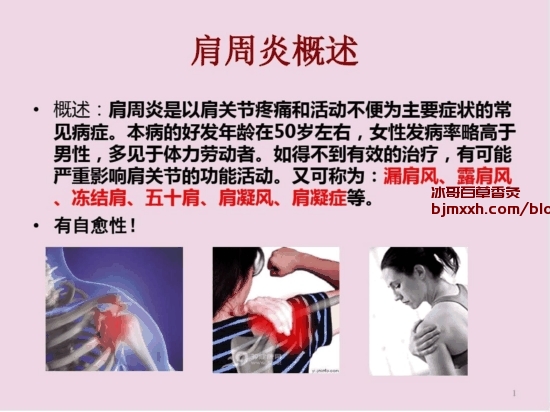 《解析肩周炎：成因、症状与饮食禁忌，如何科学养护康复 ｜ 百草香炙代理机制怎么样，古彝百草香灸能吸吗？》