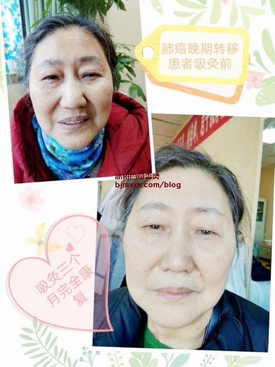 《「小日常，大养生：三招懒人健康法宝」 | 百草香灸烟是传销吗，百草香灸李大为资料？》