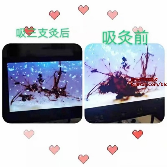 《【健康生活】告别宅家肥宅，瘦身小窍门大揭秘！ | 广西百草香灸，百草香灸烟是不是骗局？》