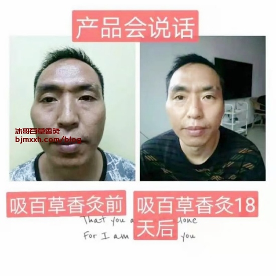 《冬季养生秘籍，告别“冻成狗”的命运！ | 吸百草香灸是真的还是的假的，百草香灸谁研发？》