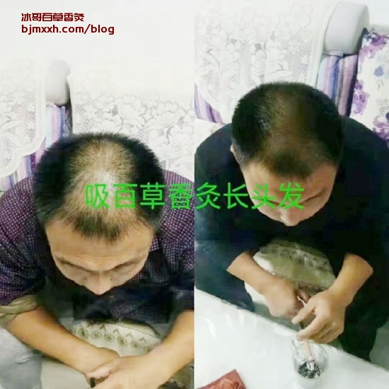 《舌尖上的养生魔法：健康饮食大公开！ | 百草香灸香灸配方，百草香灸创始人赵玉庆？》