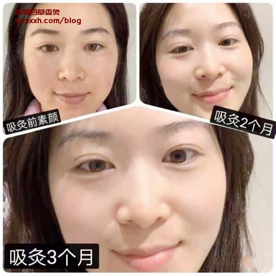 《【养生小窍门】懒人也能拥有健康生活，快来get秘诀！ | 吸百草香灸好吗有效果吗怎么样，百草香灸是真的还是假的？》
