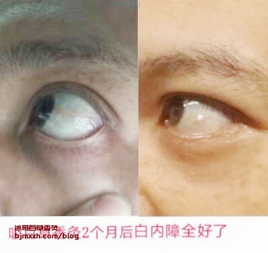 《打败秋季乏力，让精力充沛的秘诀！ | 百草香灸的制作方法，百草香灸到底好不好怎么辨别？》