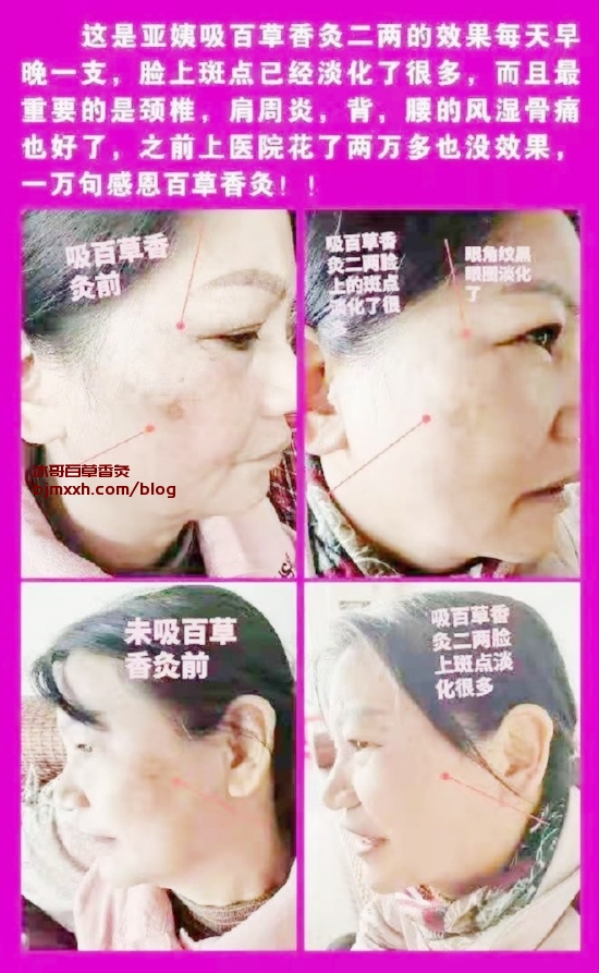 《吃货福音！美味巧克力的养生秘密 | 吸百草香灸禁忌什么食物和水果，云南百草香灸生产厂家地址电话？》