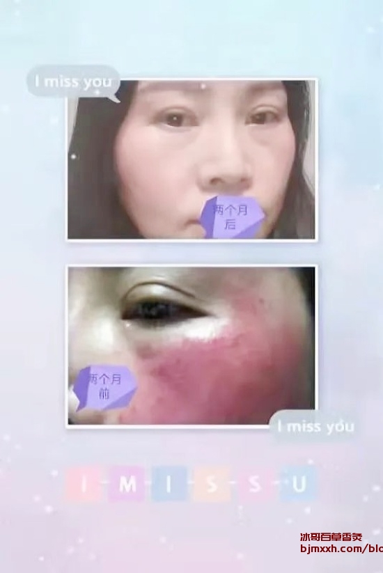 《吃出好养生，做个食家的养生达人 | 百香草吸灸怎么样好吗，百草香灸能治近视吗？》