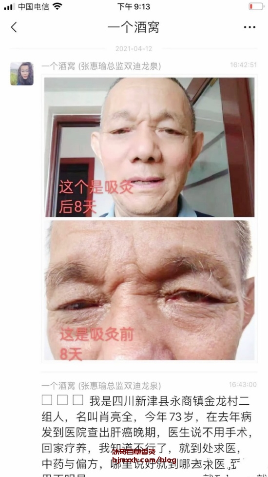 《养生不是仙术，是生活的香辣调味料！ | 能抽的百草香灸有哪些牌子，即墨区卖百草香灸的店有哪些电话？》