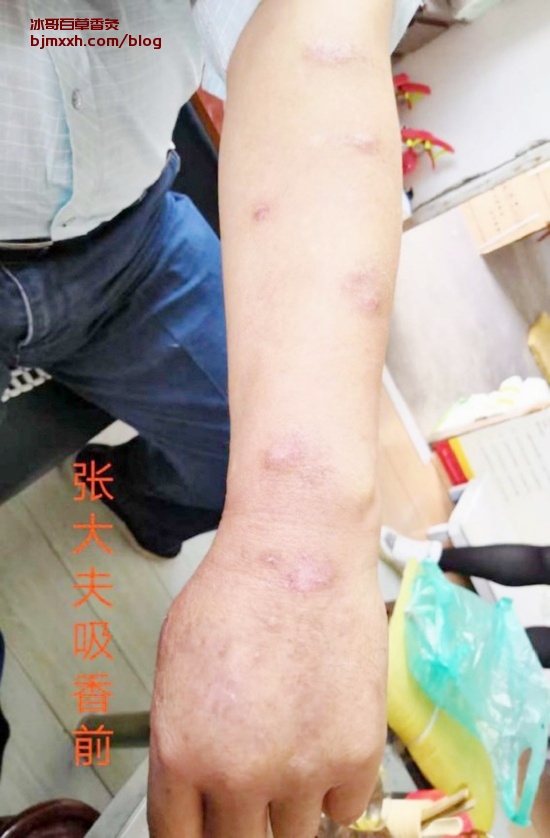 《懒人养生秘籍：健康也可以轻松有趣 | 新百草香灸真的能治病吗，百草香灸空罐在哪里买到的正宗？》