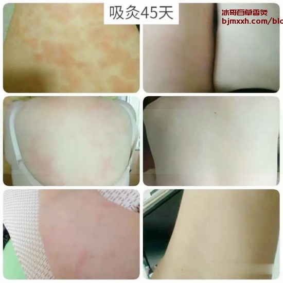 《猫奴养生：跟猫咪学习健康生活的小窍门！ | 吸了百草香灸会咳嗽吗为什么不好，百草香灸是哪里的产品？》