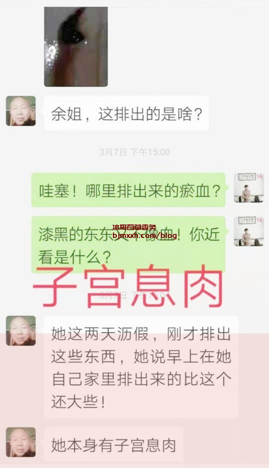 《口袋里的小秘密：养生保健就靠这些神器！ | 吸百草香灸能瘦下来吗，百草香灸注意事项症有哪些？》