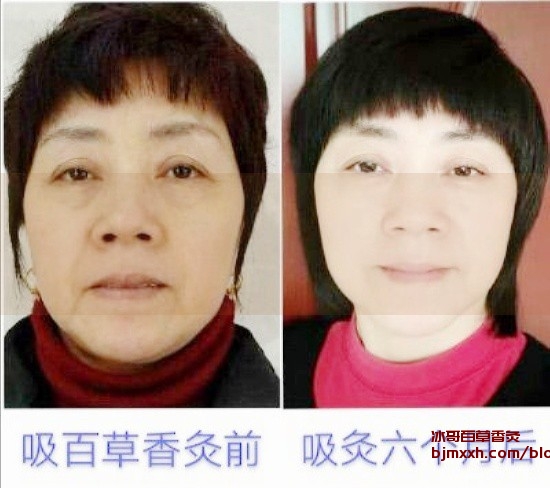 《快乐吃货，轻松养生！ | 方百草百草香灸，白草香灸公司简介？》