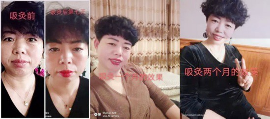 《吃货福利来了！美味饮食也能养生 | 吸百草香灸对身体好吗，百草香灸是什么东西？》