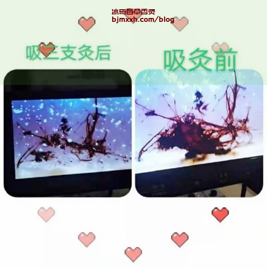 《养生秘籍大揭秘：健康饮食，中医妙方，让你年轻有活力！ | 怎么加入百草香灸团队，馨百草发酵香灸能治病吗？》