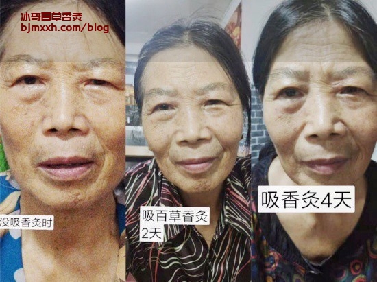《健康饮食狂想曲：吃出好身体 | 百草香灸厂家联系方式查询，古彝百草香灸治疗痛风吗？》