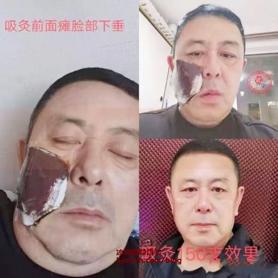 《健康饮食的小窍门：吃得开心，活得健康！ | 香艾香灸百草香灸，百草香灸的副作用和禁忌症？》