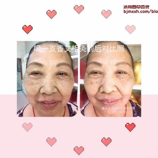 《奇妙的养生冒险：一颗牙糖的奇幻之旅 | 抽百草香灸胸口痛正常吗，吸百草香灸每天吸多少只？》