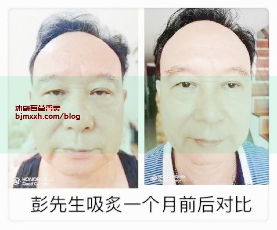 《生命之水：为什么每天都要多喝水 | 百草香灸注意事项有哪些禁忌和副作用，济南百草香灸电话？》