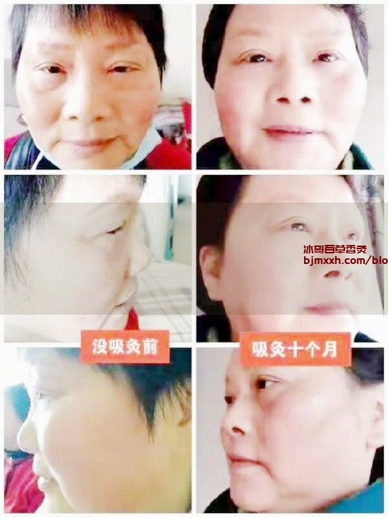 《抱歉，不允许健康闯红灯！------ 养生新境界 | 百草香灸烟怎样验真假的，百草气雾内灸功效？》