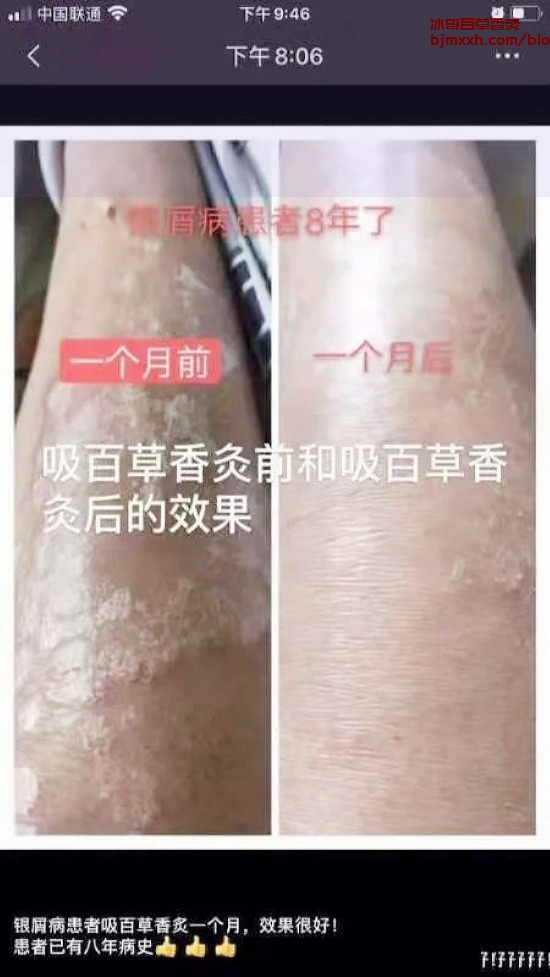 《养生小窍门：吃对食物，活出精彩人生 | 百草香灸代理加盟费多少，百草香灸吸了为什么会头晕恶心呕吐？》