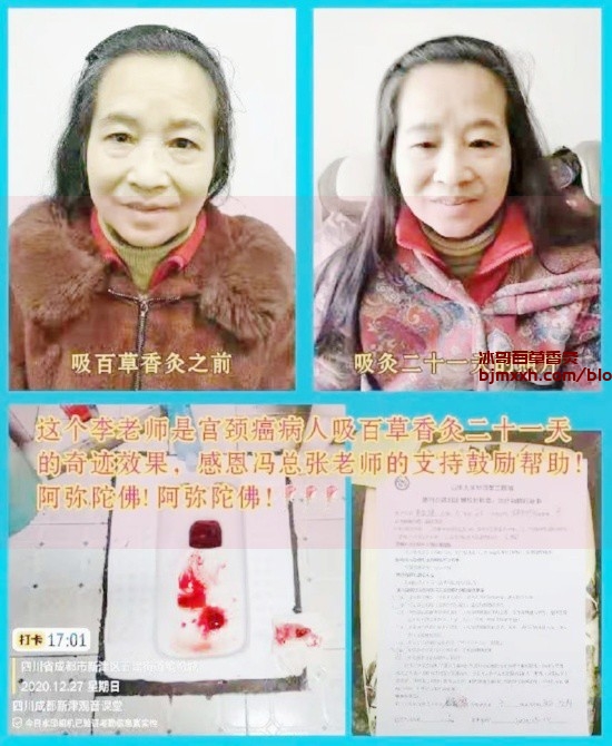 《别慌，轻松养生攻略来了！ | 李大为百草香灸有何功效，百草相艾香灸？》