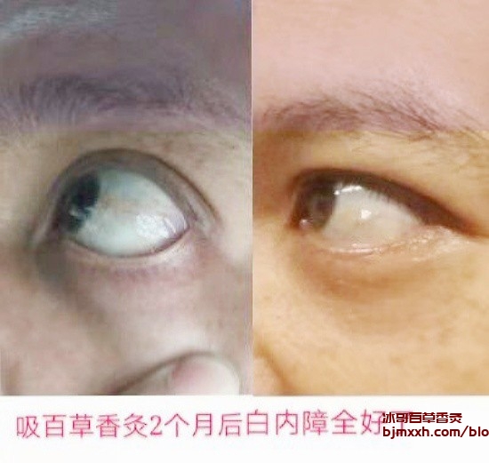 《活力十足的秘密武器：全面养生攻略 | 吸百草香灸后胃部不舒服正常吗怎么回事，吸百草香艾烟有好处吗？》