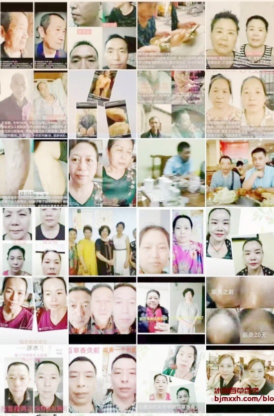 《中医养生秘籍：古老智慧，现代健康 | 金艾源百草香灸，百草香灸效果怎么样？》