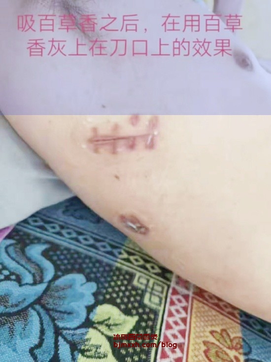 《懒人也能养生，拯救你的懒癌生活！ | 百草香灸的坏处和好处，百草香灸有焦油吗？》