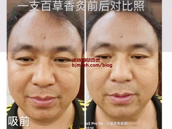 《魔法养生法宝：吃对食物，活出精彩！ | 百草发酵香灸可靠吗有效果吗怎么用的，百草香灸的副作用？》