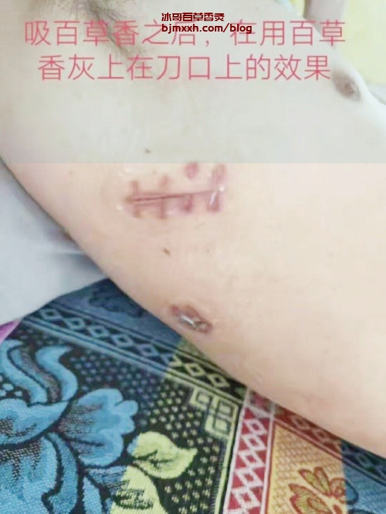 《奇妙的食物魔法：吃出健康与活力 | 百草香灸主要成份，百草香灸治病能治小细肺癌吗？》