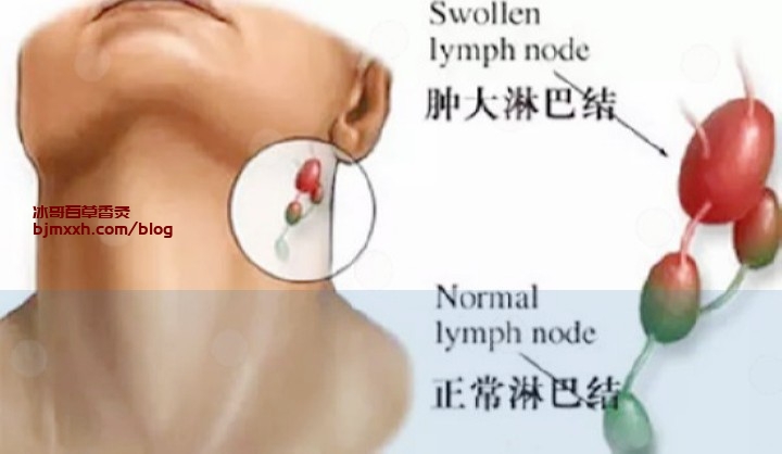 《爱吃不怕胖！健康美食让你瘦成闪电侠 | 云南百草香灸生产厂家地址在哪里，彝族百草香灸李大为？》